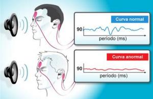  Los potenciales evocados auditivos de tronco cerebral (PEATC)