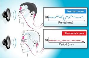  Auditory evoked potentials (AEPs)